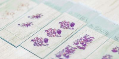 Photo of histology samples mounted on slides in the clinical laboratory.