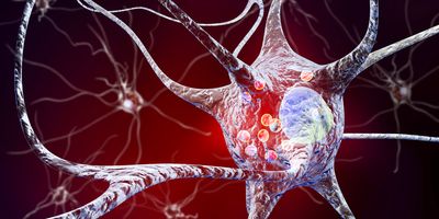 3D illustration showing neurons containing Lewy bodies small red spheres which are deposits of proteins accumulated in brain cells that cause their progressive degeneration.