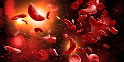 3D illustration of sickle cell disease (SCD) blood cells.