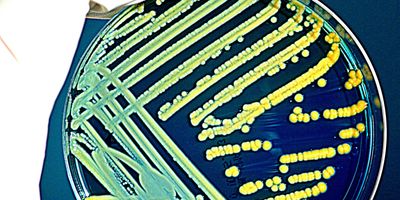 Microbial culture plate of superbug, Klebsiella pneumonia, which is resistant to most antibiotics.
