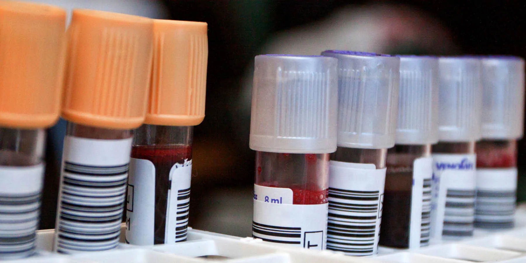 Now and Forever: How Useful is PFAS Testing? Photo of blood samples in test tubes ready for PFAS testing in a clinical lab.
