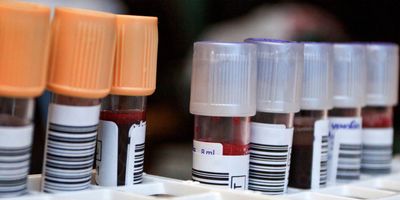 Photo of blood samples in test tubes ready for PFAS testing in a clinical lab.