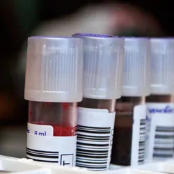 Photo of blood samples in test tubes ready for PFAS testing in a clinical lab.