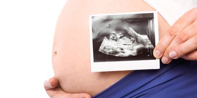 A pregnant woman shows an ultrasound scan of her baby as she holds her belly.