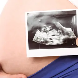 A pregnant woman shows an ultrasound scan of her baby as she holds her belly.