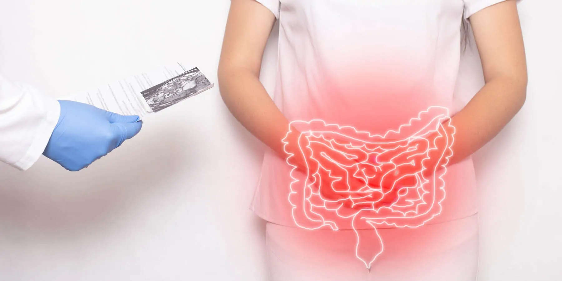 The doctor holds the results of the examination of a patient with intestinal inflammation and abdominal pain.