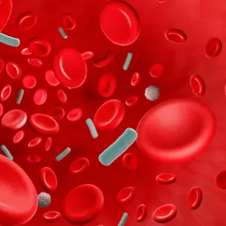 Illustration of a blood infection causing sepsis.