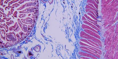 Microscopic image of normal small bowel microscopic section with trichrome stain for immunohistochemistry.