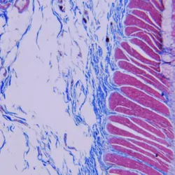 Microscopic image of normal small bowel microscopic section with trichrome stain for immunohistochemistry.
