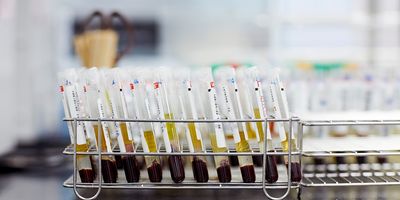 Blood tubes separated into red, yellow, and white (blood vs. plasma) phases shown in metal rack with laboratory backdrop. 
