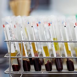 Blood tubes separated into red, yellow, and white (blood vs. plasma) phases shown in metal rack with laboratory backdrop. 