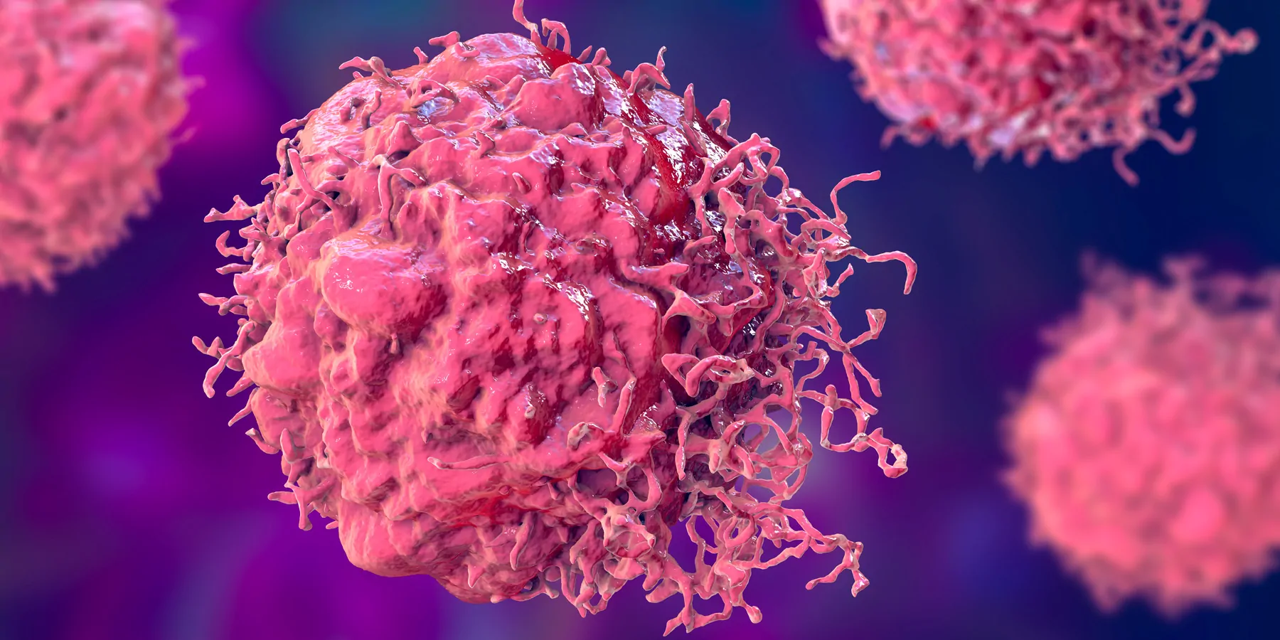 Computer image of tumor cells