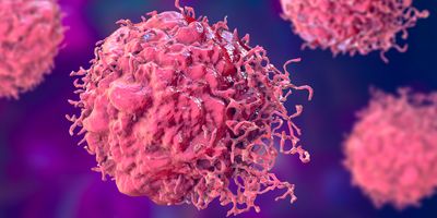 Computer image of tumor cells