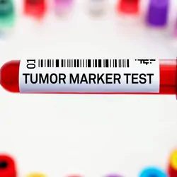 A clinician holds a blood vacutainer labeled "Tumor marker test" for analysis of cancer biomarkers.