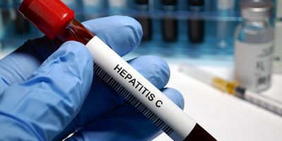 Photo of a laboratory blood test tube labeled ‘hepatitis C.”