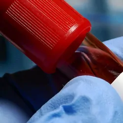 Photo of a laboratory blood test tube labeled ‘hepatitis C.”