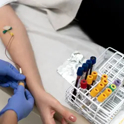 A nurse draws blood from a patient and fills several blood vacutainers that are arranged in a stand.