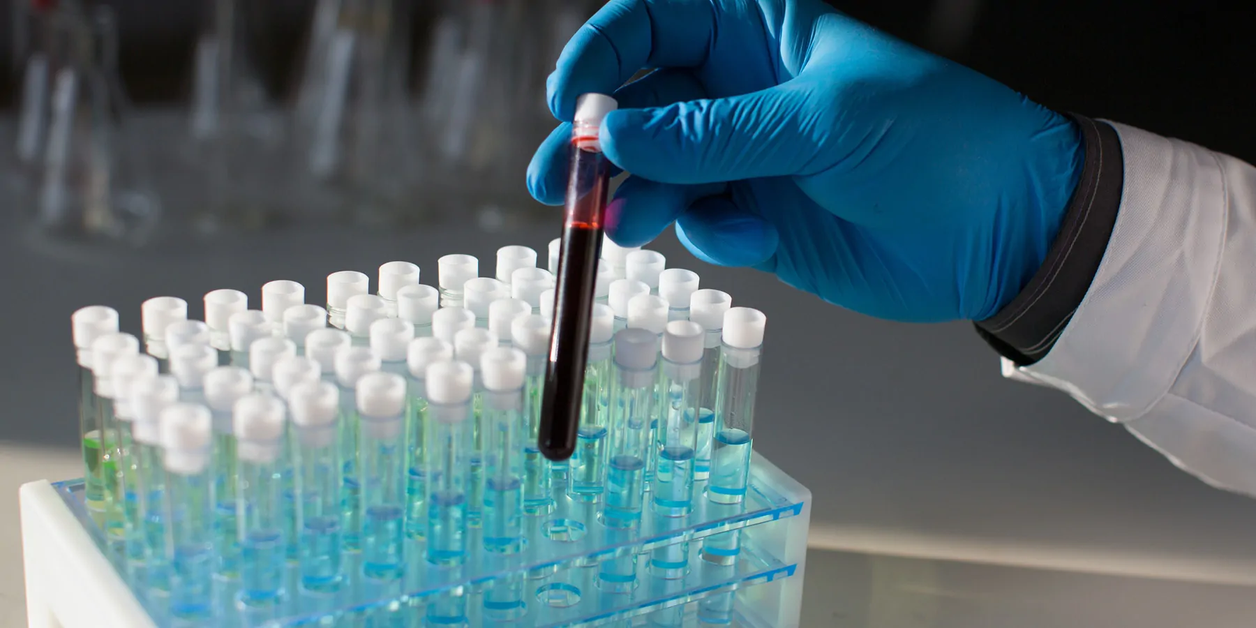 Close-up of a clinician holding a  test tube with a sample of blood to be tested in a laboratory.