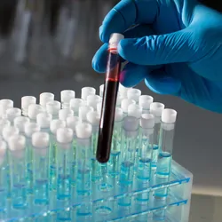 Close-up of a clinician holding a test tube with a sample of blood to be tested in a laboratory.
