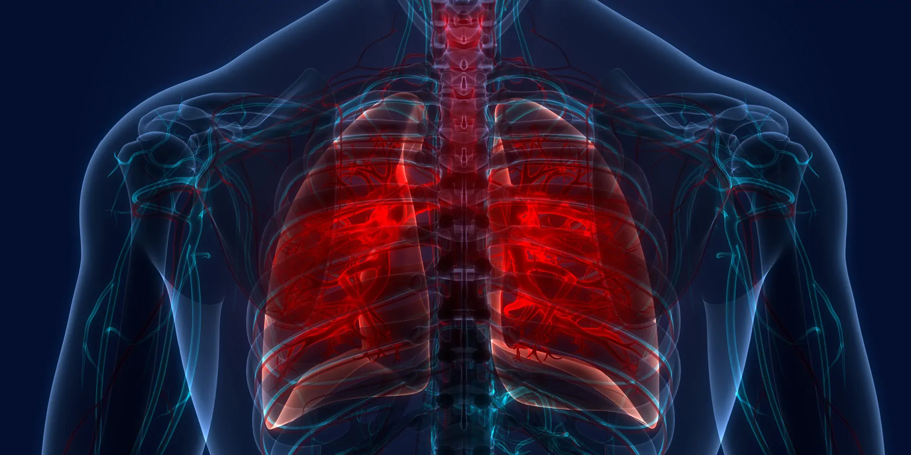 WHO Launches Comprehensive Web-Based TB Screening Tool 3D illustration of human lungs with highlighted infected areas.