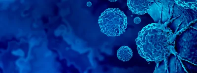 Cancer Outbreak