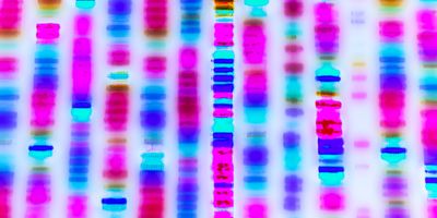 Graphic representation of bands of DNA sequence on a gel.