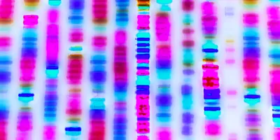 Graphic representation of bands of DNA sequence on a gel.