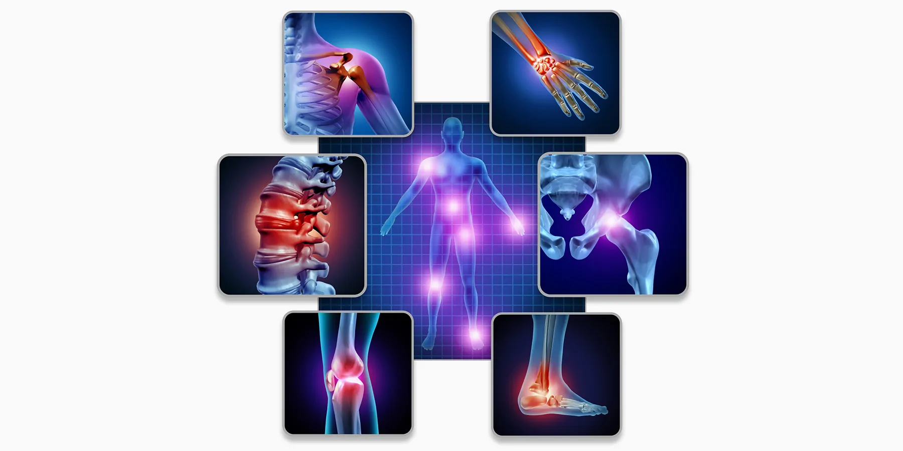 3D rendering of the human skeleton and muscle anatomy of the body with a group of sore joints indicating inflammation.