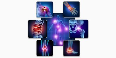 3D rendering of the human skeleton and muscle anatomy of the body with a group of sore joints indicating inflammation.