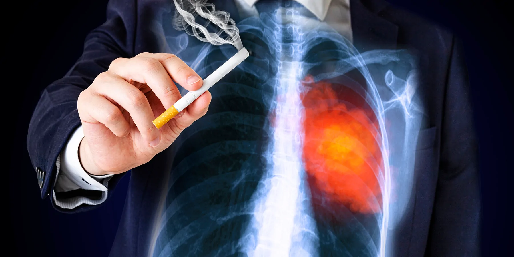 A man holding a cigarette before his chest where his lungs can be seen as an X-ray film showing a reddened affected area on the left.