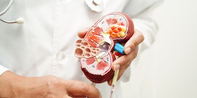 A clinician holds a model of a human kidney showing the anatomy.