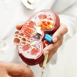 A clinician holds a model of a human kidney showing the anatomy.