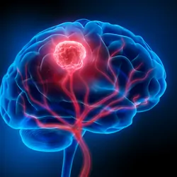 3D illustration of a human brain with tumor.