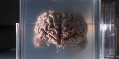 Human brain samples preserved in plastic slides.