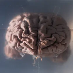 Human brain samples preserved in plastic slides.