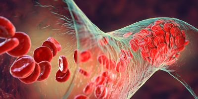 3D illustration of a blood clot forming with red blood cells in a blood vessel.