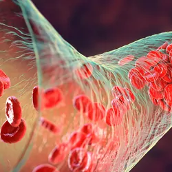 3D illustration of a blood clot forming with red blood cells in a blood vessel.