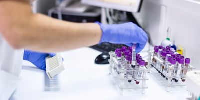 Laboratory staff with blue gloves handles purple capped blood tubes in a laboratory tube rack with white laboratory equipment in the background.