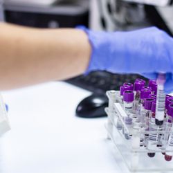 Laboratory staff with blue gloves handles purple capped blood tubes in a laboratory tube rack with white laboratory equipment in the background.