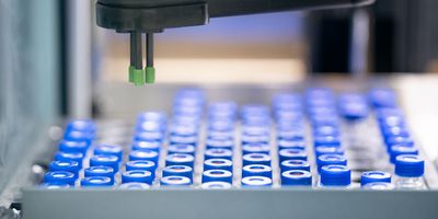 Photo of laboratory-developed tests sample tubes in a clinical laboratory.