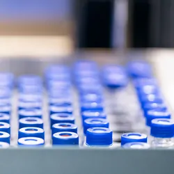 Photo of laboratory-developed tests sample tubes in a clinical laboratory.