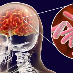 3D illustration of bacterial meningitis showing rod-shaped bacilli near a human brain representation.