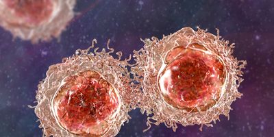 3D illustration of cancer cells.