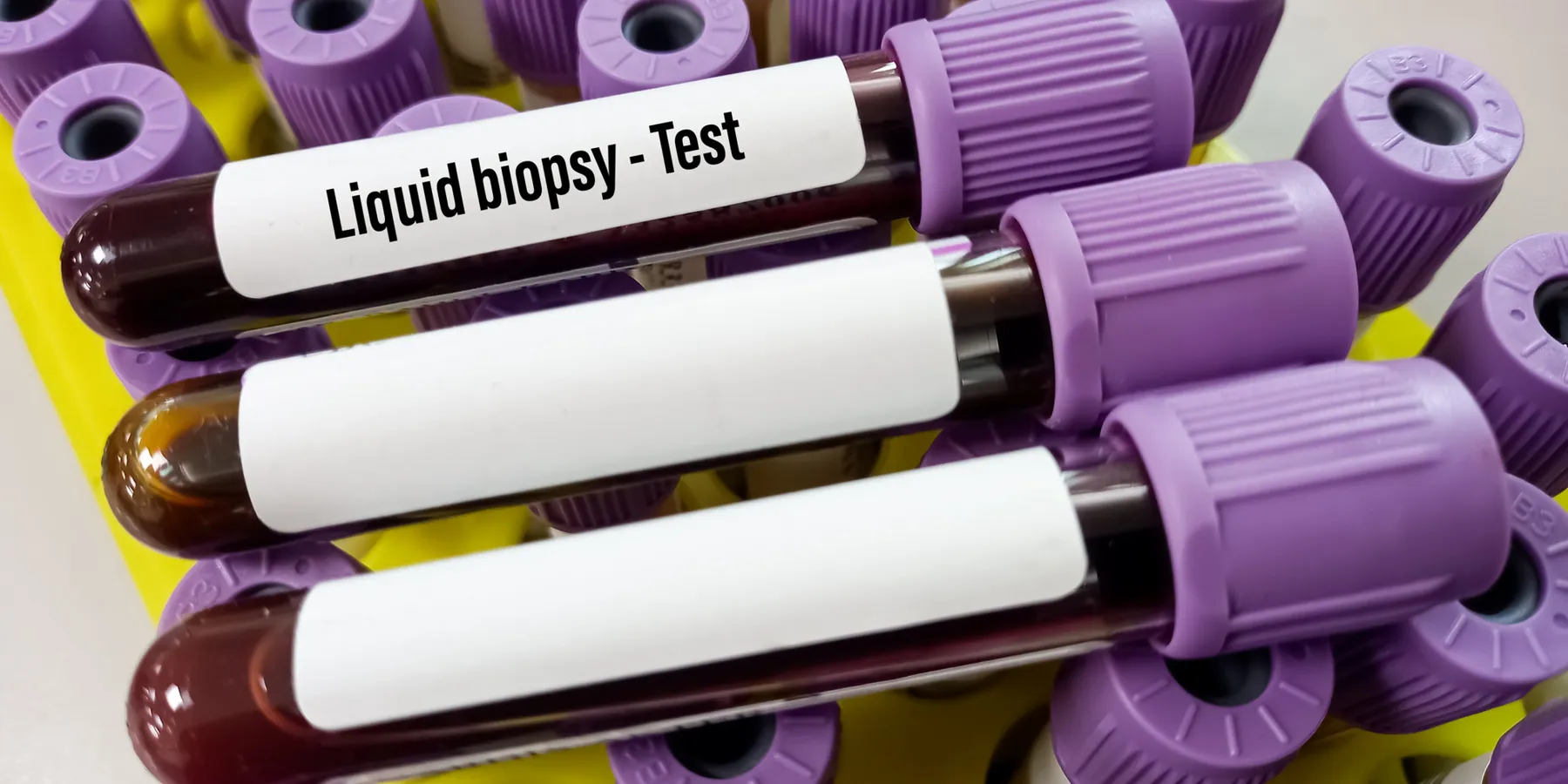 Blood vacutainers with "Liquid Biopsy Test" printed are arranged on a test tube rack with more vacutainers.