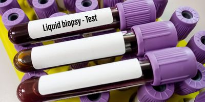 Blood vacutainers with "Liquid Biopsy Test" printed are arranged on a test tube rack with more vacutainers.