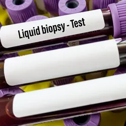 Blood vacutainers with "Liquid Biopsy Test" printed are arranged on a test tube rack with more vacutainers.
