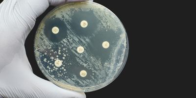 Photo of an agar plate with Antibiogram Kirby Bauer Antimicrobial susceptibility diffusion test.