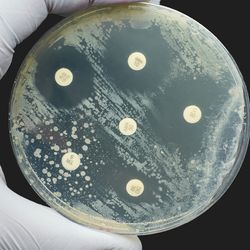 Photo of an agar plate with Antibiogram Kirby Bauer Antimicrobial susceptibility diffusion test.