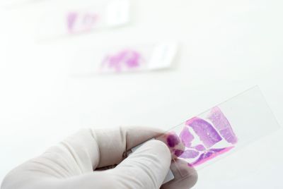 Future Directions for Established Cancer Biomarkers