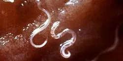 Ancylostoma caninum, a type of hookworm, attached to the intestinal mucosa